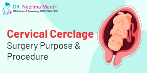 Cervical Cerclage Surgery Purpose & Procedure - Dr. Neelima Mantri
