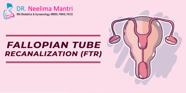 Fallopian Tube Recanalization (FTR)
