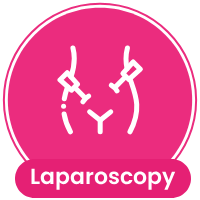 Laparoscopy Treatment