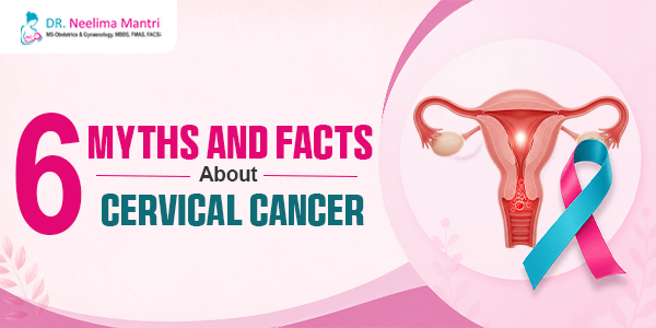 6 Myths And Facts About Cervical Cancer